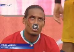 VIDEO: Va chạm nảy lửa, Van Dijk đổ máu trong trận giao hữu của Liverpool